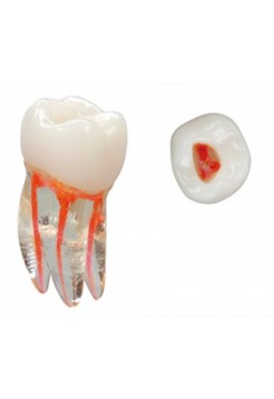 Эндо Трейнер Зуб (Endo Training tooth) (НДС 18%)